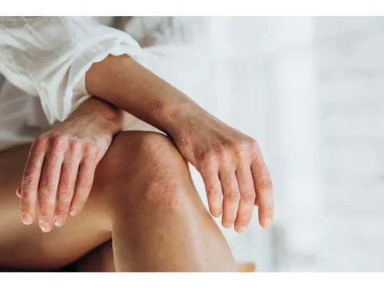 BIO Skin reparator 100ml