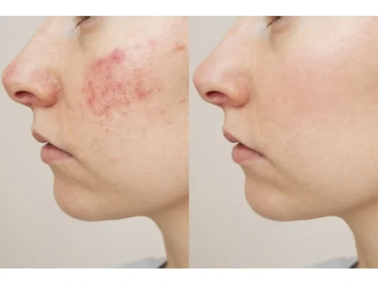 BIO Skin reparator 100ml