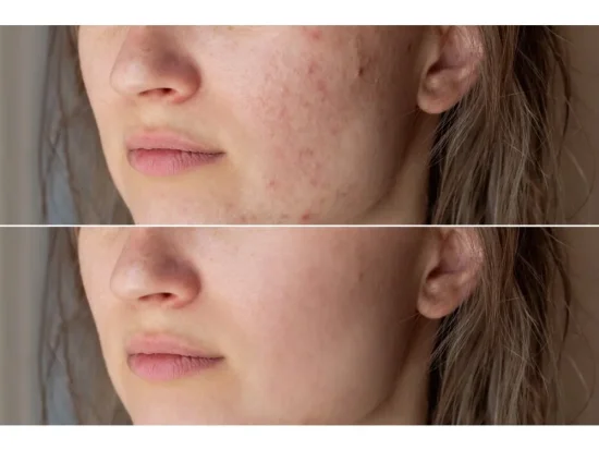 BIO Skin reparator 100ml